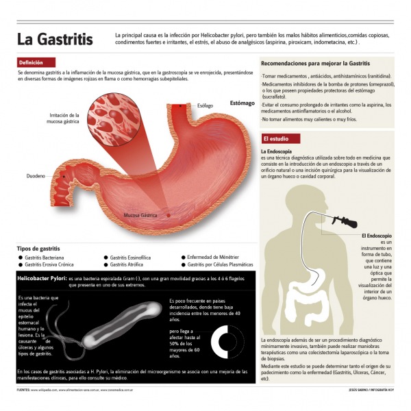 La gasrtritis