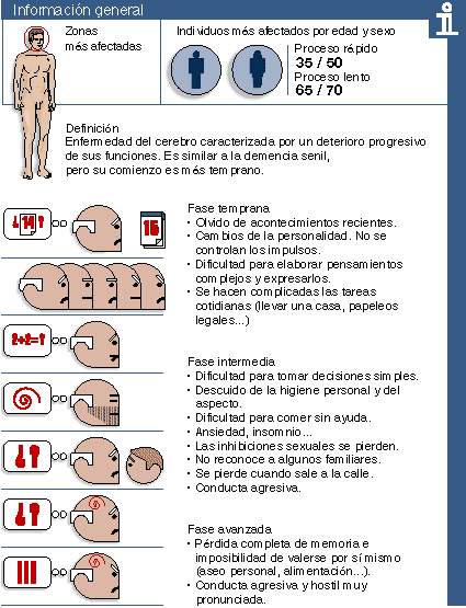 La evolución del alzheimer