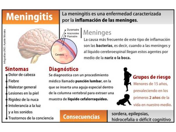 Qué es la meningitis