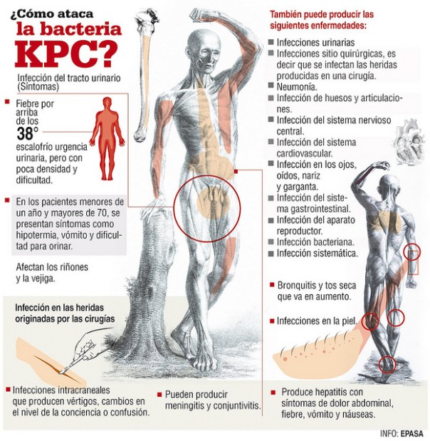 Cómo ataca la bacteria KPC