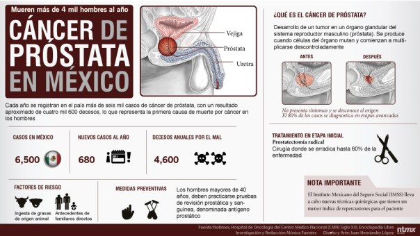 Cáncer de próstata