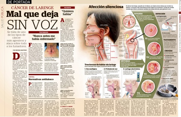 Cáncer de laringe