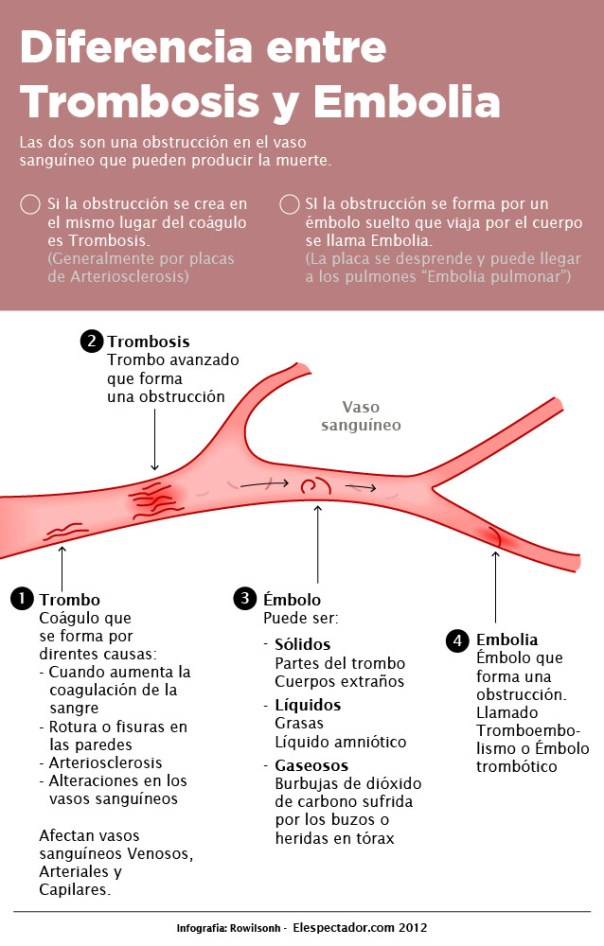 Diferencia entre trombosis y embolia