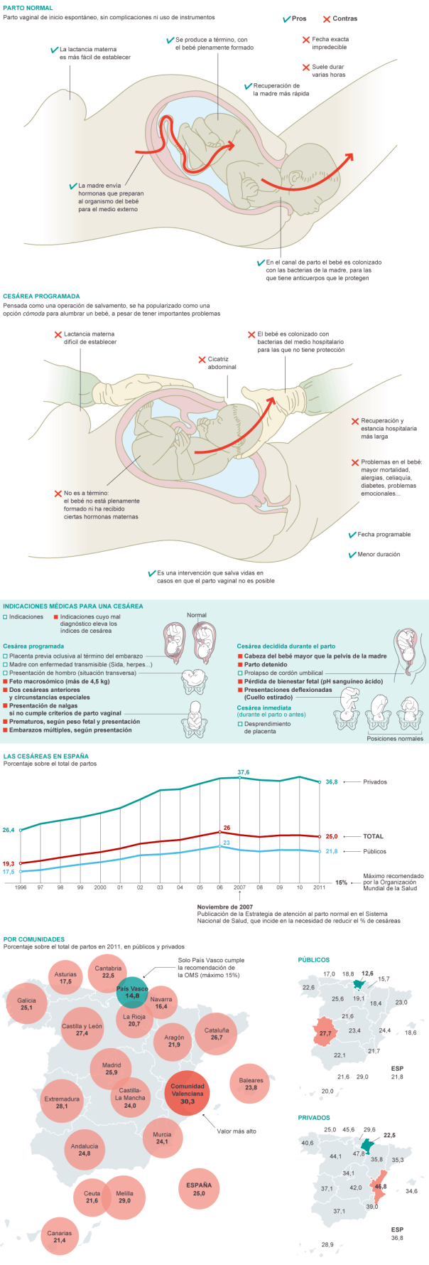 Luces y sombras de la cesárea en España