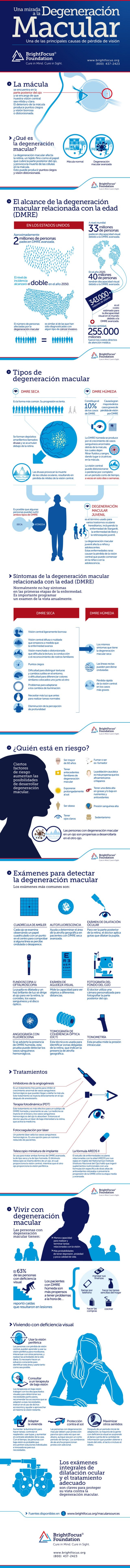 Degeneración macular