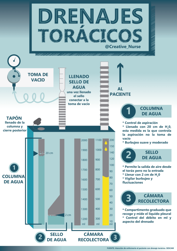 Drenajes torácicos #infografia